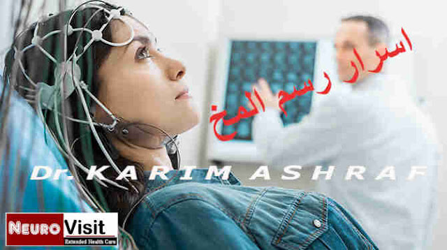 اسرار رسم المخ