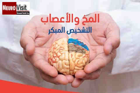 افضل ماهومعروف عن امراض المخ و الاعصاب في 2019 - التشخيص