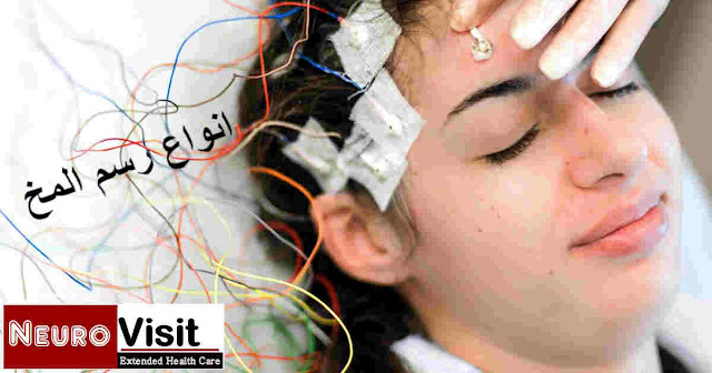 انواع رسم المخ