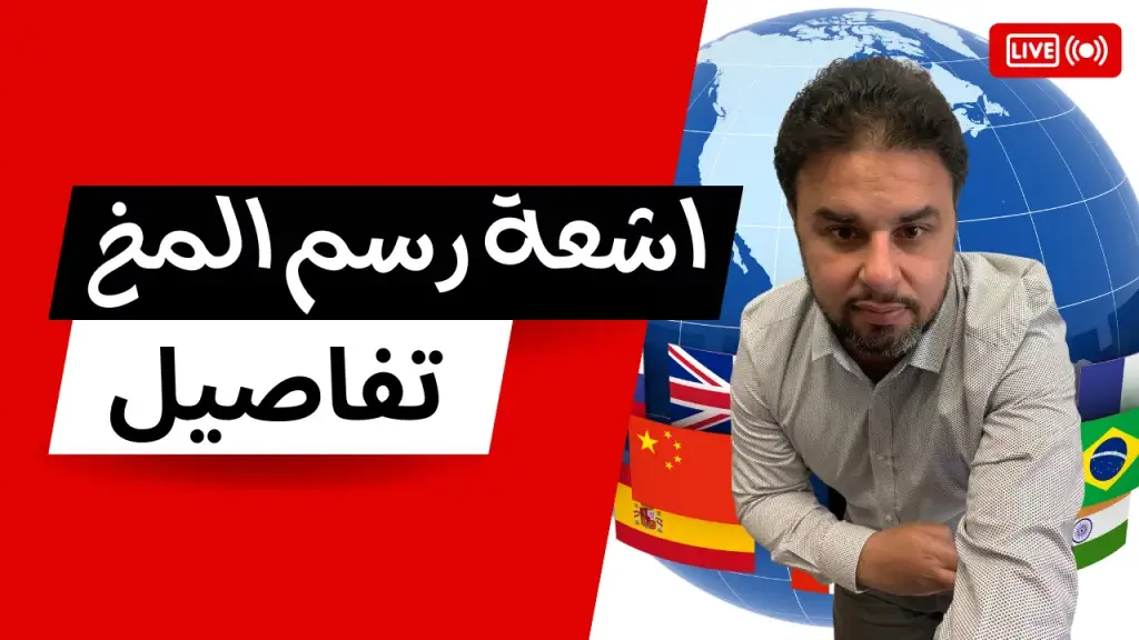 اشعة رسم مخ