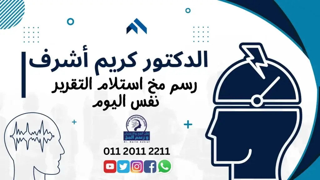 عمل رسم مخ