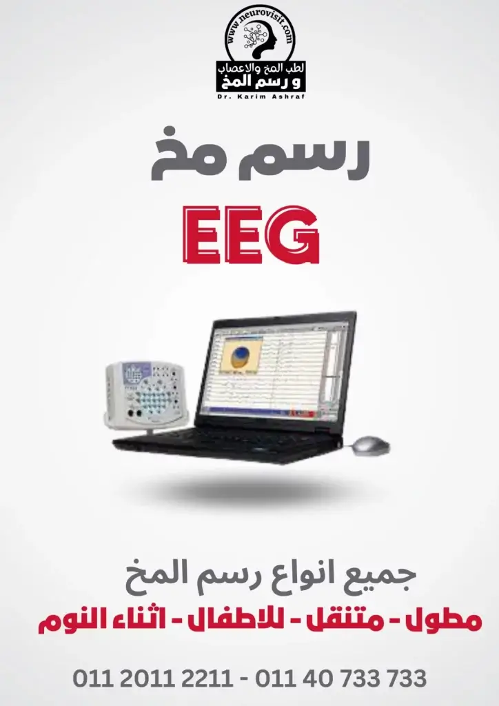 رسم مخ دكتور كريم اشرف