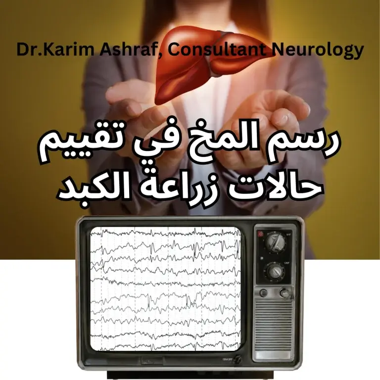 دور رسم المخ في تقييم حالات زراعة الكبد