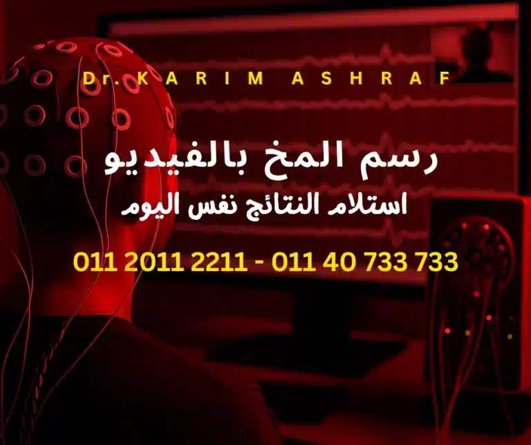 اماكن رسم المخ بالفيديو