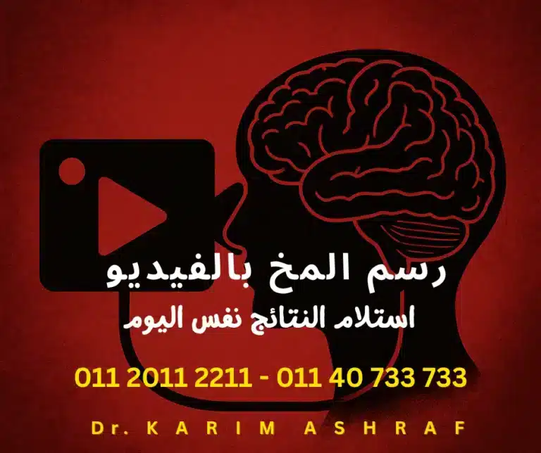 سعر رسم المخ بالفيديو