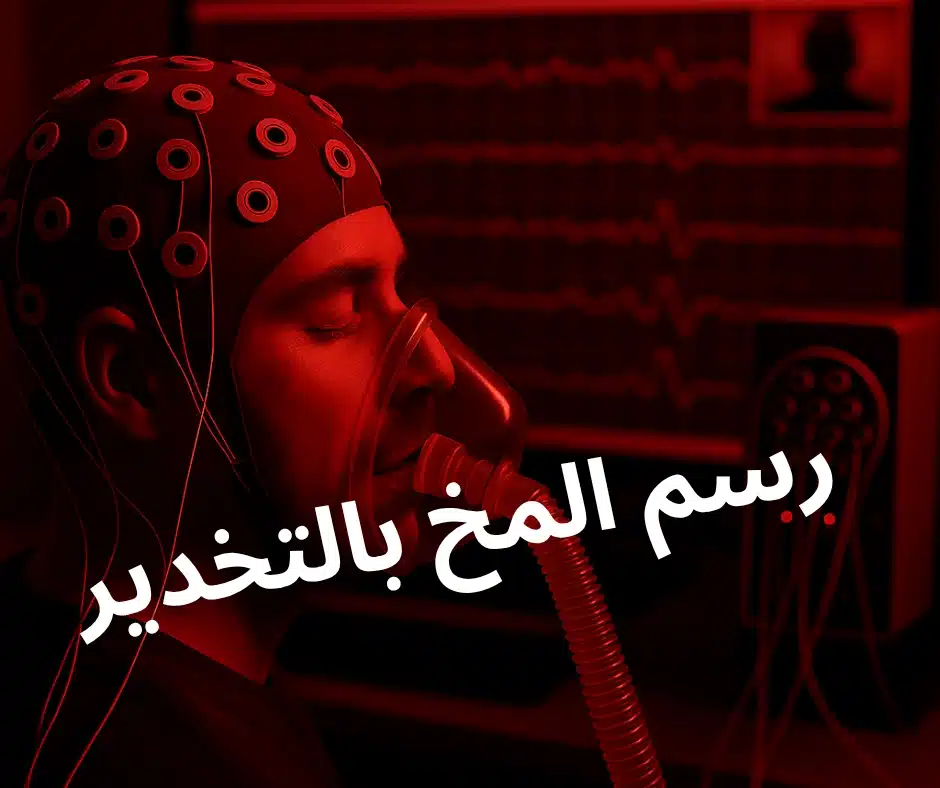 رسم المخ بالتخدير